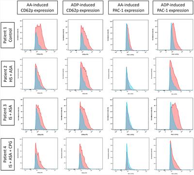 Feasibility and comparability of different platelet function tests in acute stroke with or without prior antiplatelet therapy